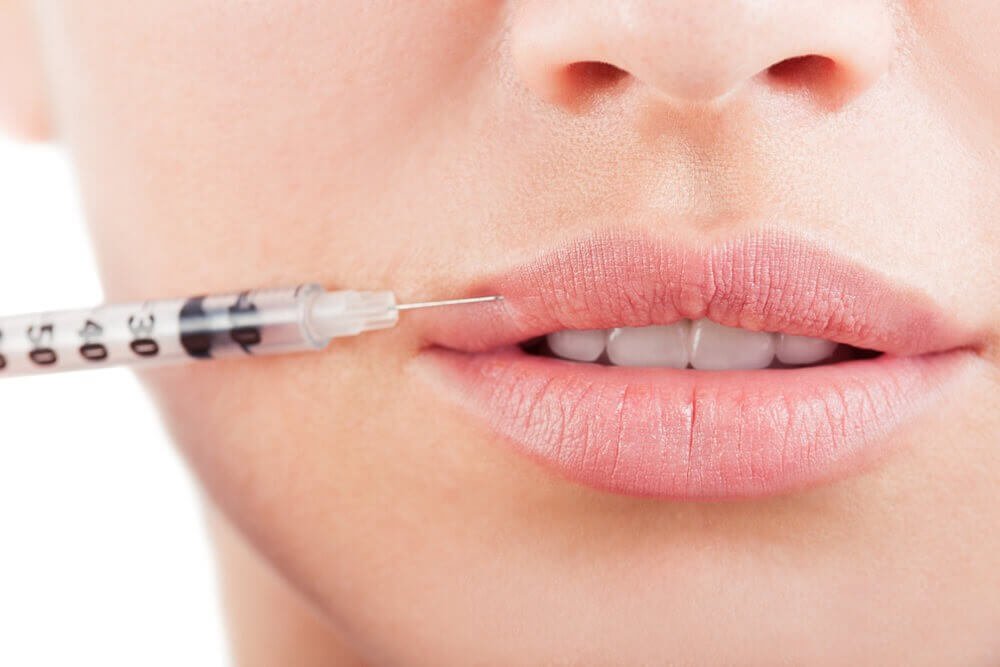 Lip Filler Injections in Dubai