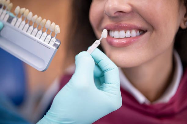 Teeth cleaning and polishing in Riyadh