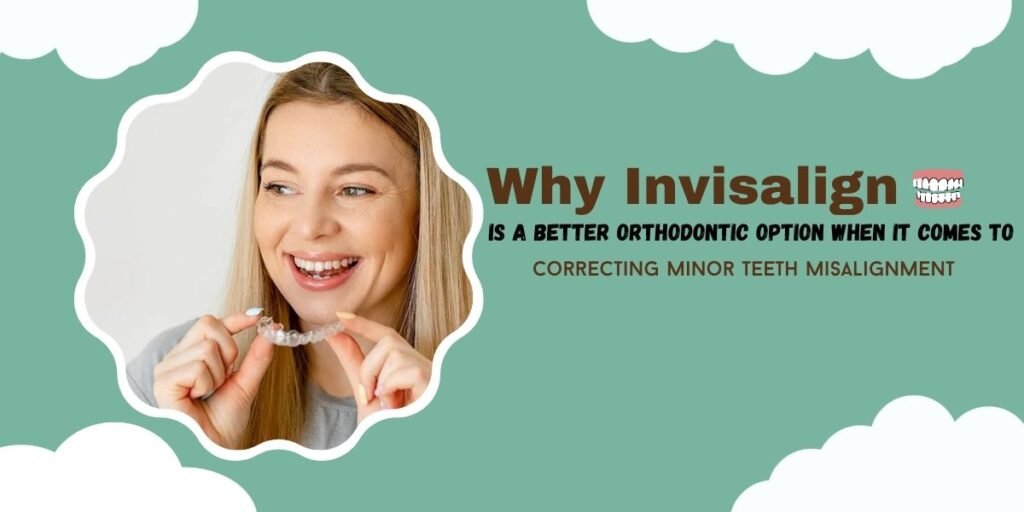 Why Invisalign is a Better Orthodontic Option When It Comes to Correcting Minor Teeth Misalignment