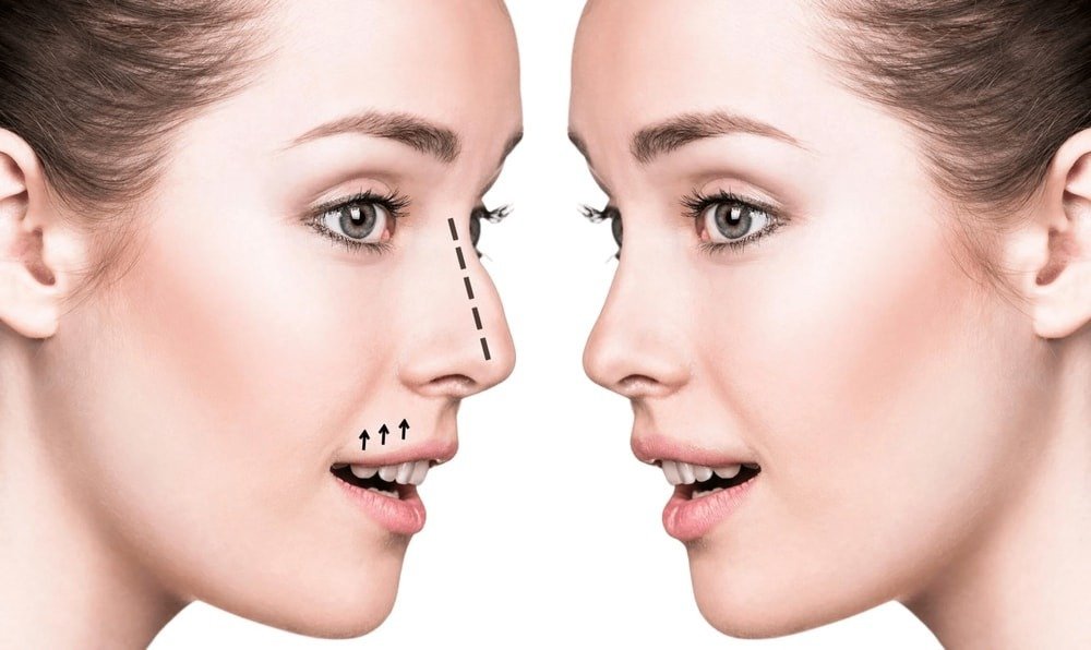 How to Choose the Best Rhinoplasty Surgeon in Dubai for Your Nose Surgery