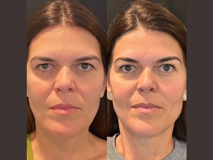 best plastic surgeons in dubai