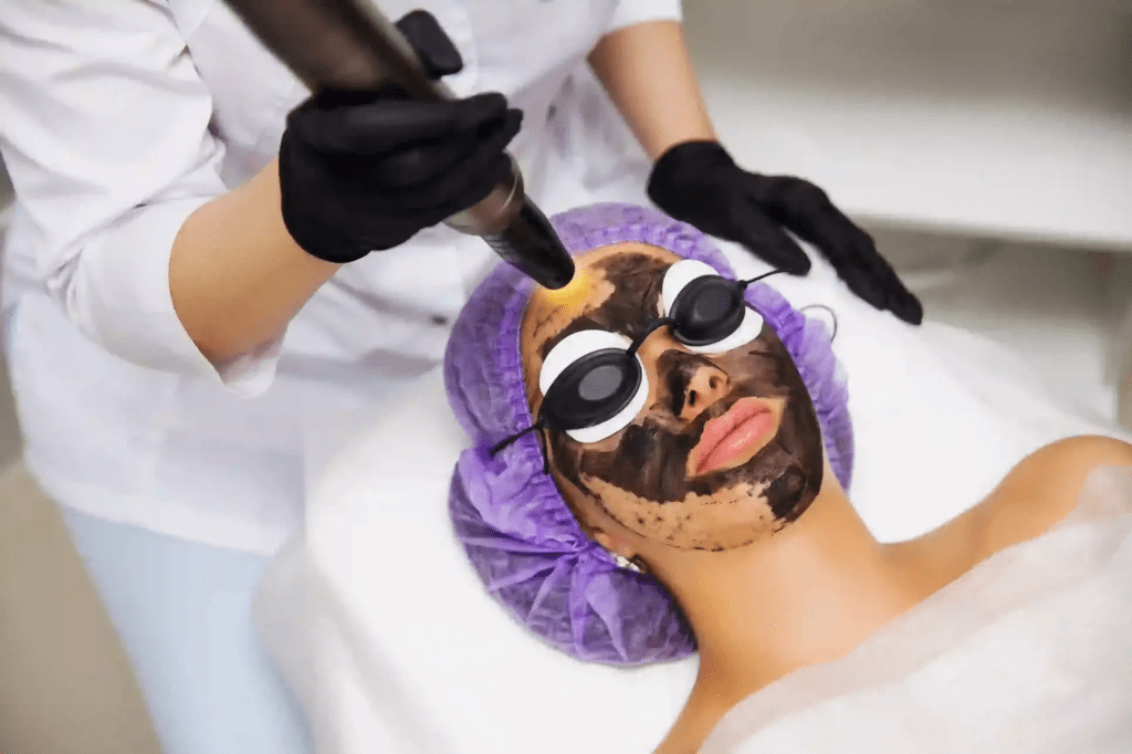 Does Laser Carbon Peel Help Reduce Blackheads?