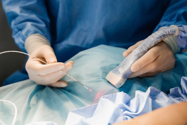 Restore Comfort and Beauty with Varicose Veins Treatment