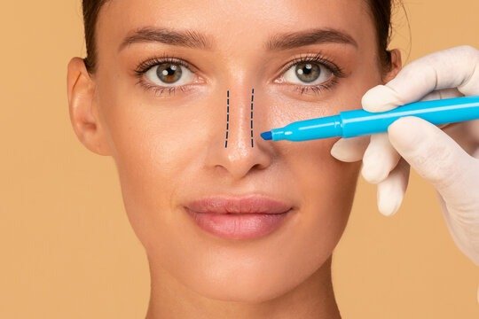 Rhinoplasty Surgery in Dubai