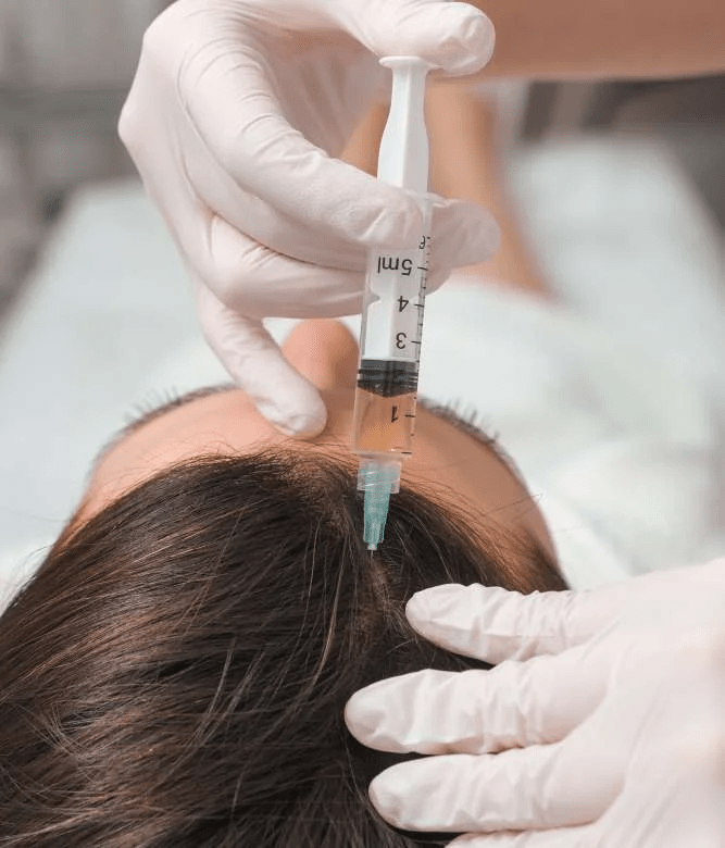 Step by Step Guide to PRP Hair Treatment