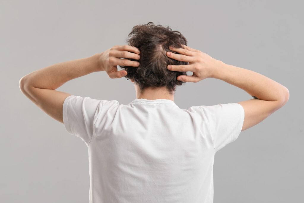 Hair Transplant in Dubai