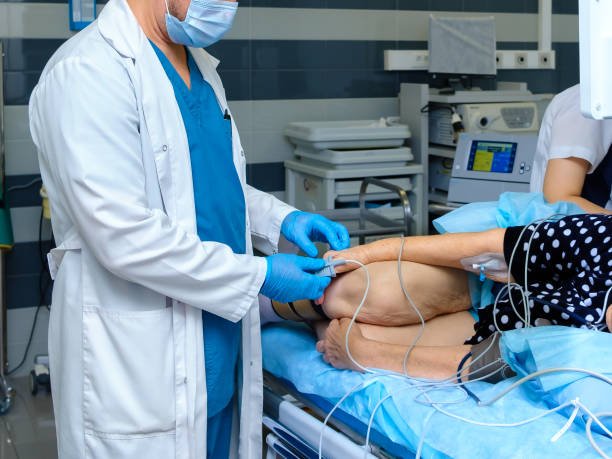 ERCP Treatment for Gallbladder Stones