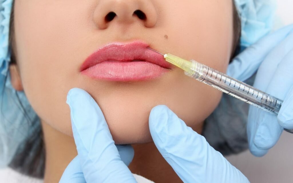 Best Lip Fillers Injections in Dubai