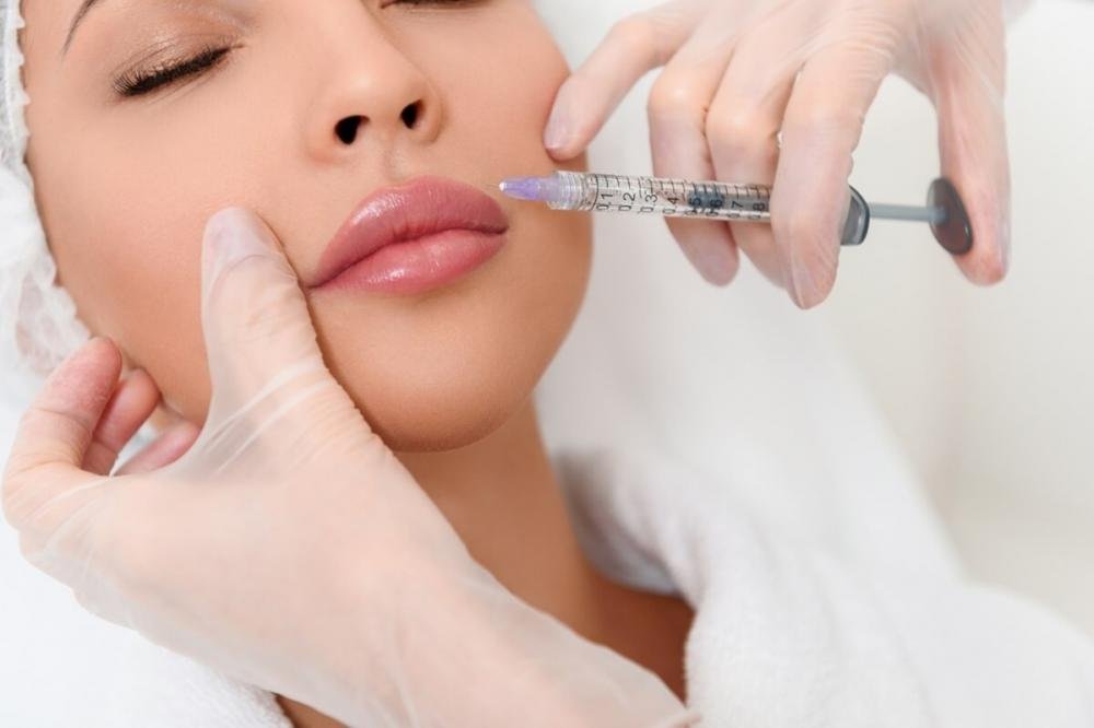 Best Lip Fillers Injections in Dubai