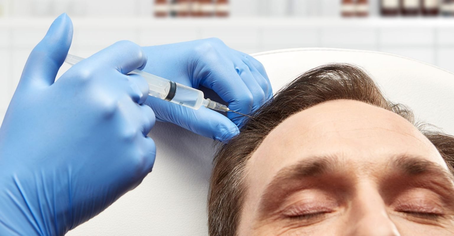 PRP Treatment Cost in Dubai