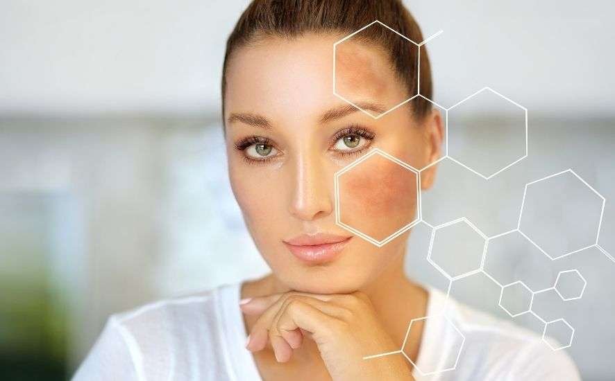 Expert Advice on Skin Whitening