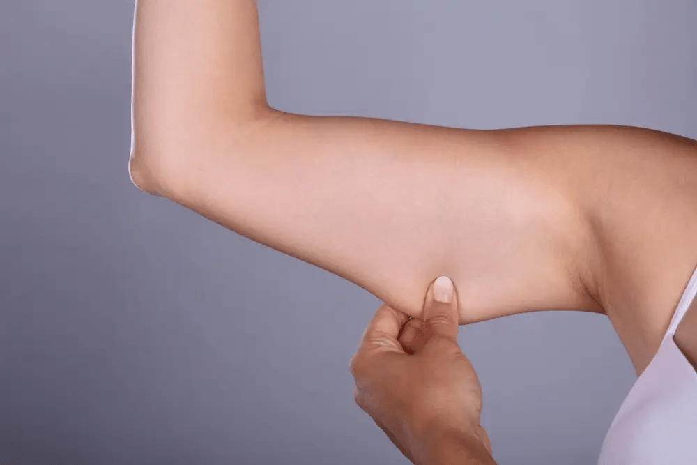 Get Flawless Contours with an Arm Lift