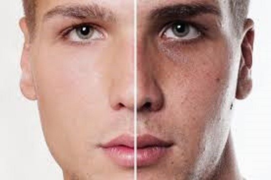 How Different Weather Conditions Impact Skin Whitening Results