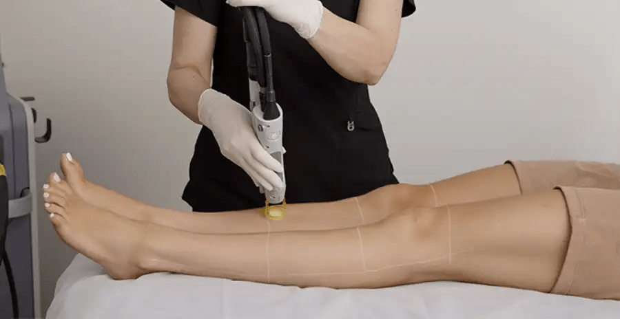 Is Laser Hair Removal Effective on Dark Skin?