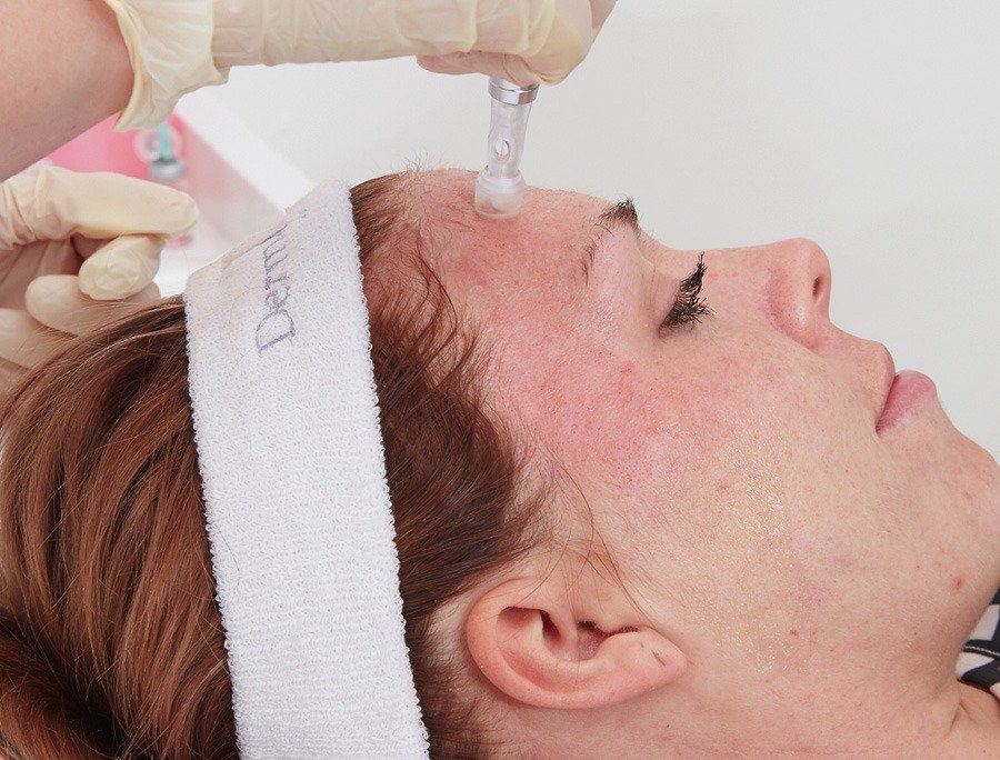 Natural Healing with Concentrated Growth Factor