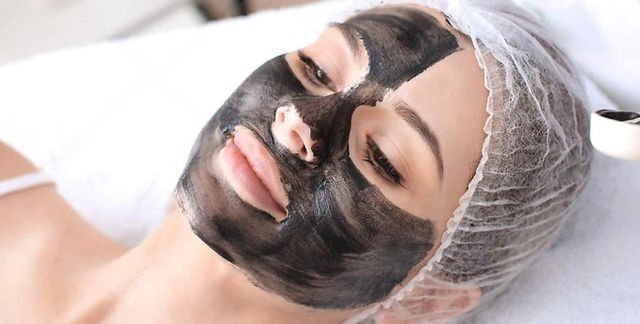 Real Results from Carbon Peel Laser Treatments