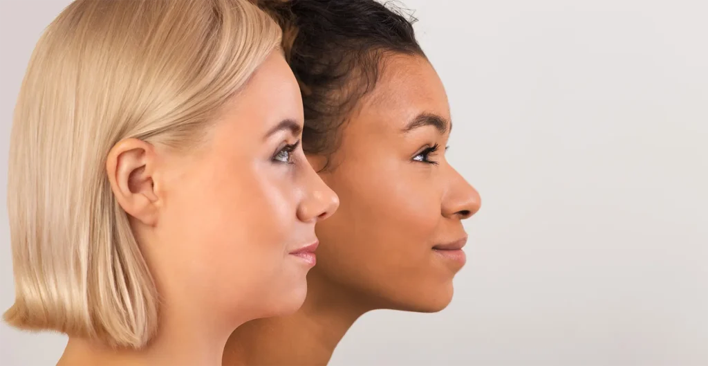 Top Benefits of Choosing Preservation Rhinoplasty in Dubai Over Traditional Techniques