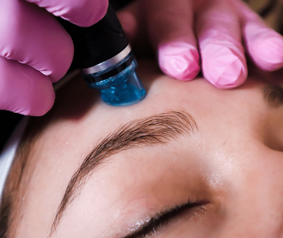 Say Goodbye to Stubborn Blackheads with the Power of HydraFacial