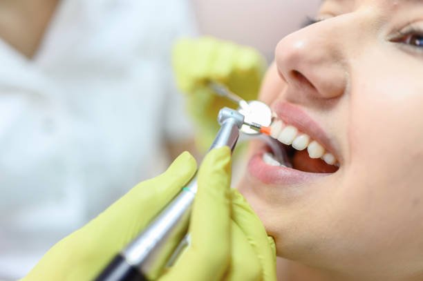 Teeth Cleaning and Polishing