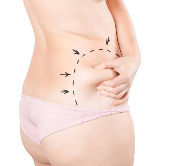 Thigh Lift Surgery in Riyadh