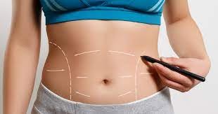 Vaser Liposuction in Dubai
