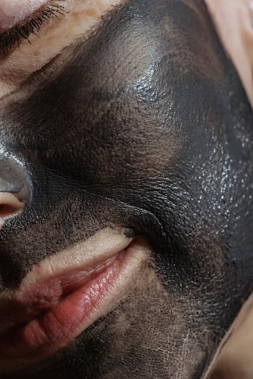 Laser Carbon Peel in Dubai