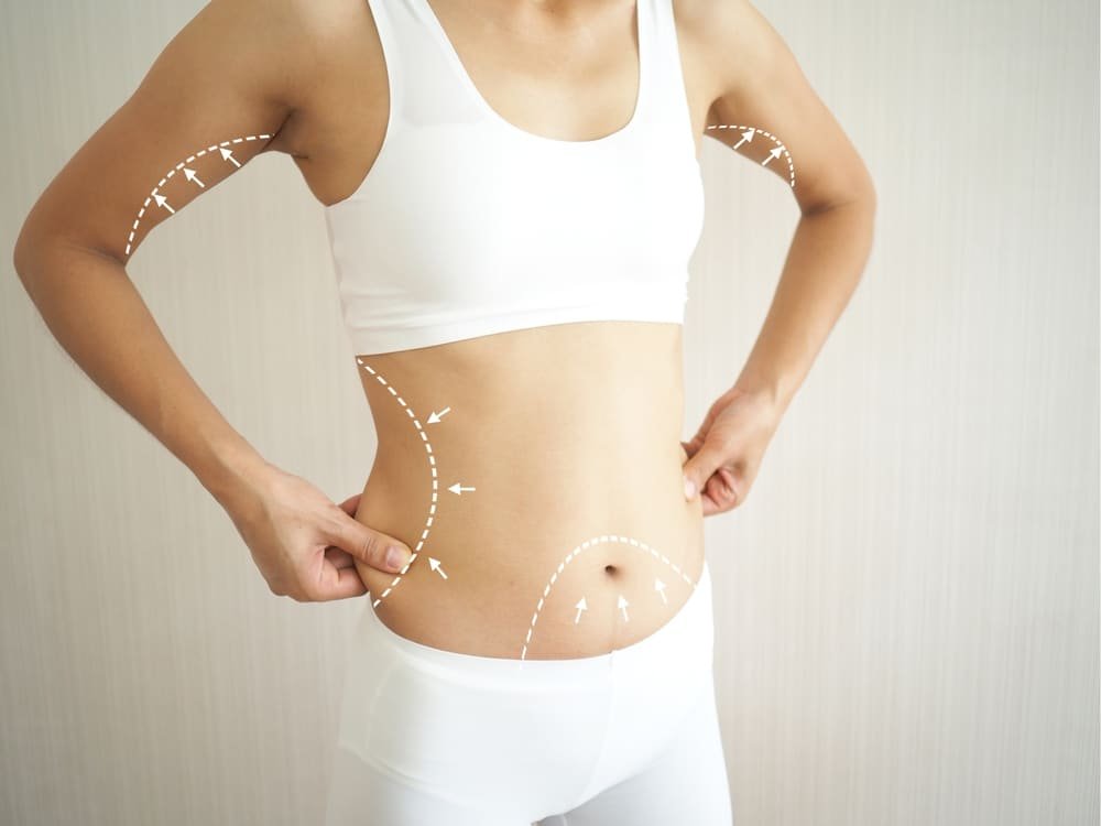 The Ultimate Guide to Finding the Best Fat Transfer Surgeons in Dubai