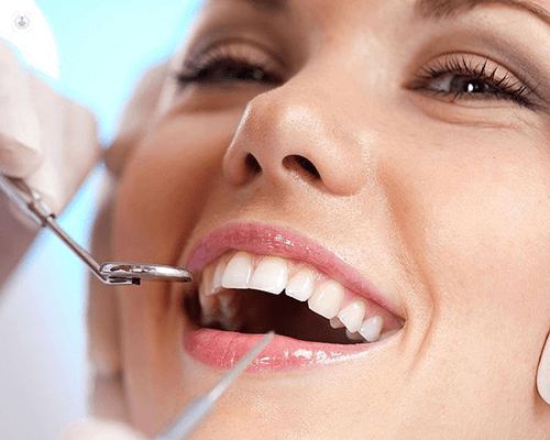 Fixed Dentures Tampa