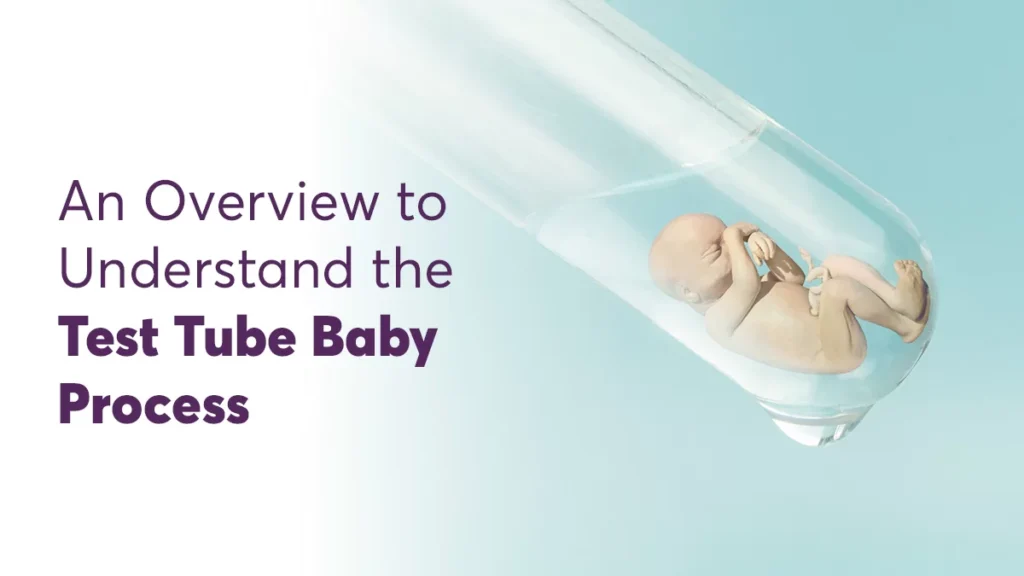Top Test Tube Baby Center In Delhi - Cost-Effective IVF Procedures with High Success Rates