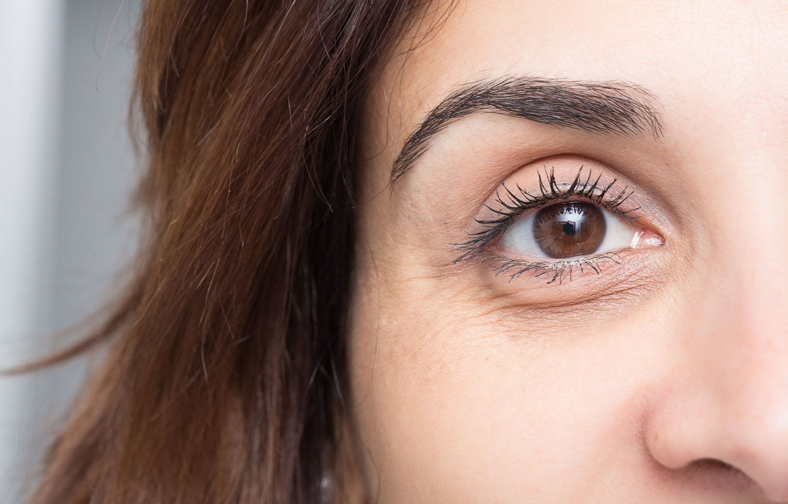 Dark Circles Treatment In Dubai