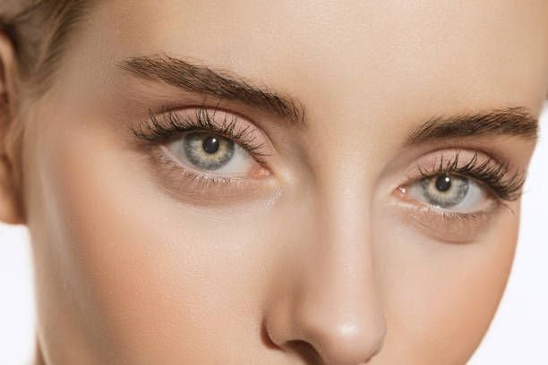 Eyelid Surgery in Dubai