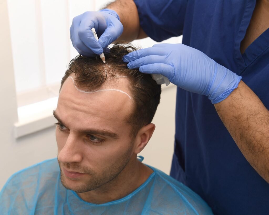 Hair Transplant in Dubai