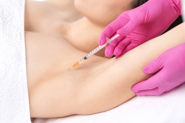 How Many Sessions for Botox Injections for Sweaty Glands