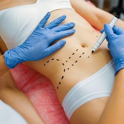 How much do fat melting injections cost