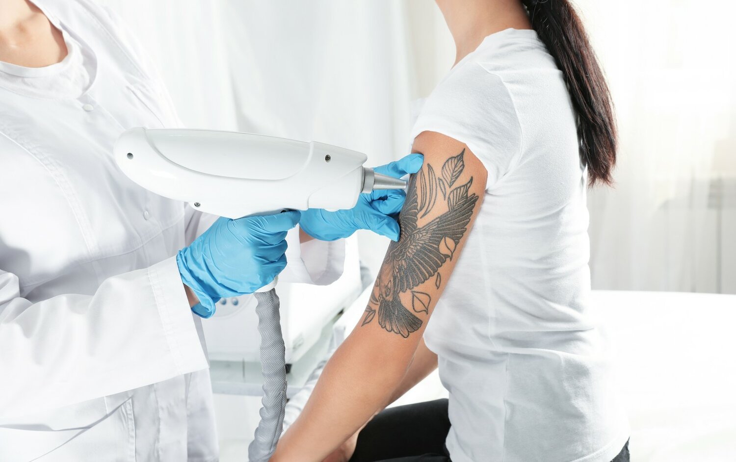 Laser Tattoo Removal in Dubai