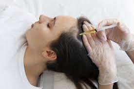 PRP hair treatment in Dubai