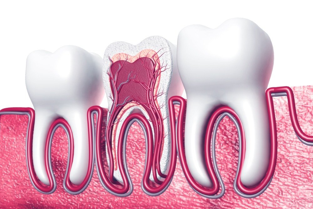 Root Canal Treatment in Islamabad
