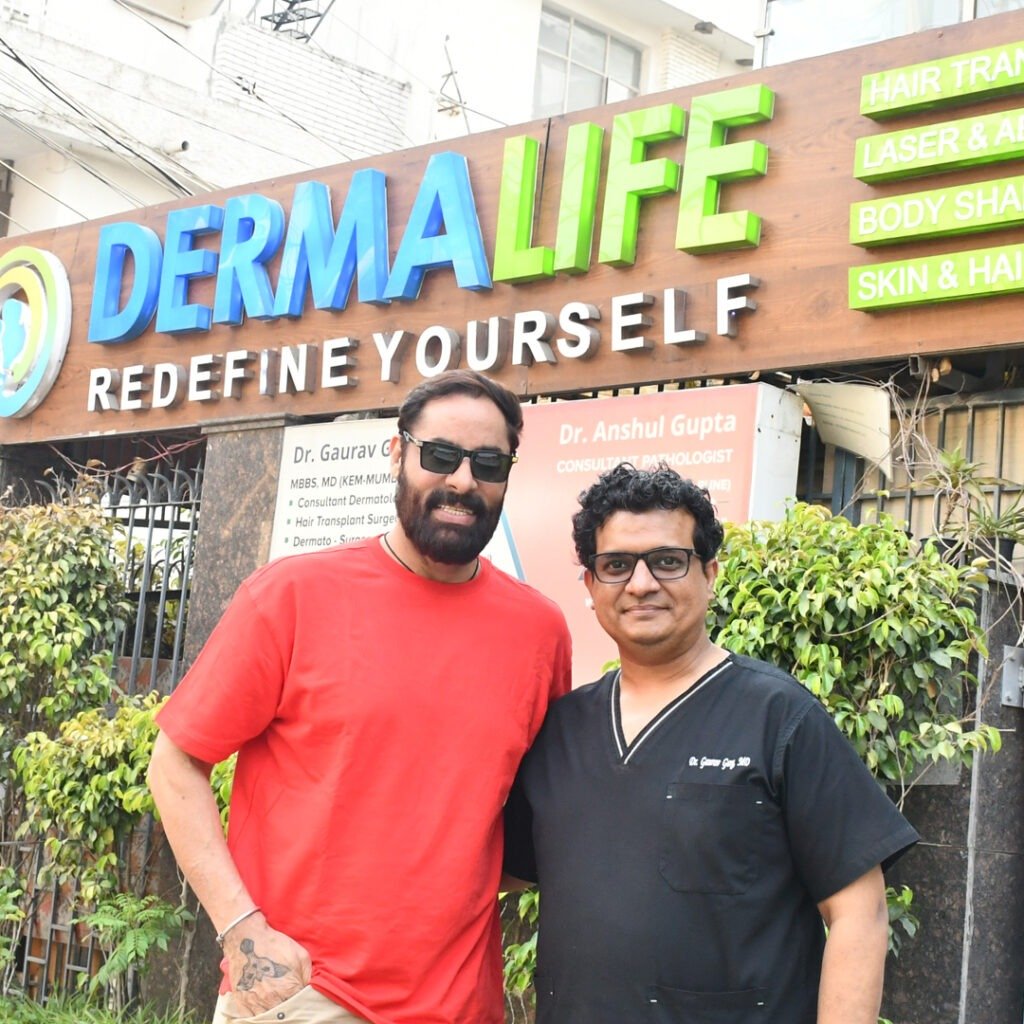 Shaji Choudhary Celebrity Hair Transplant