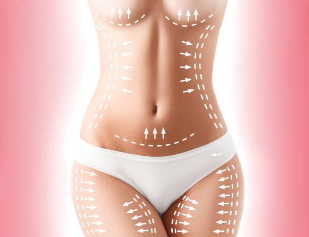 Thigh Lift Surgery in Riyadh