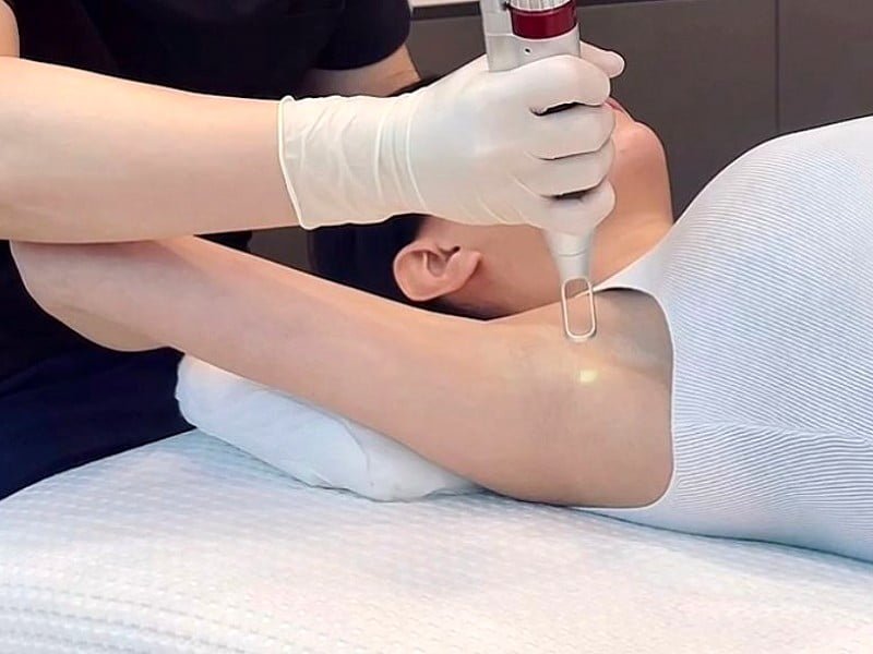 Underarm Whitening Treatments in Dubai
