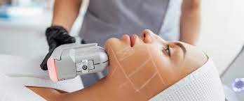 Wrinkle Removal