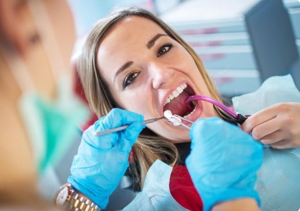 Dental Implants