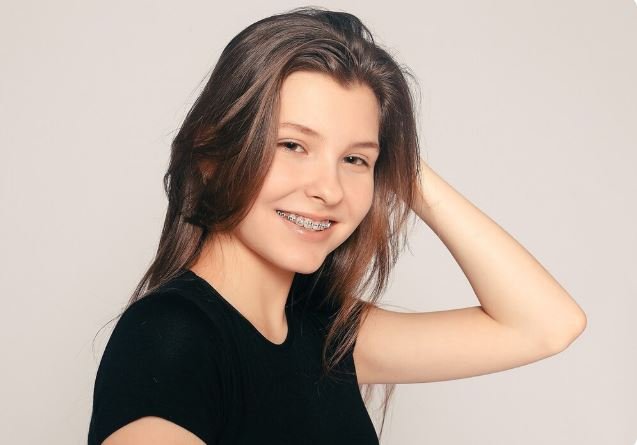 Clear Braces