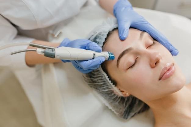 Acne Scar Removal