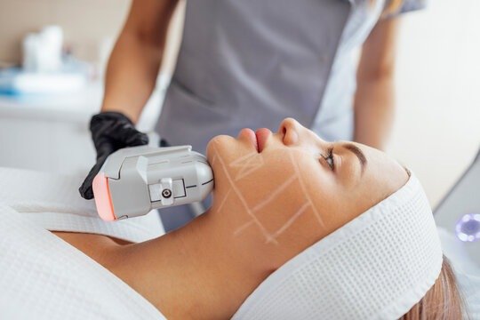 Best HIFU clinic in Islamabad