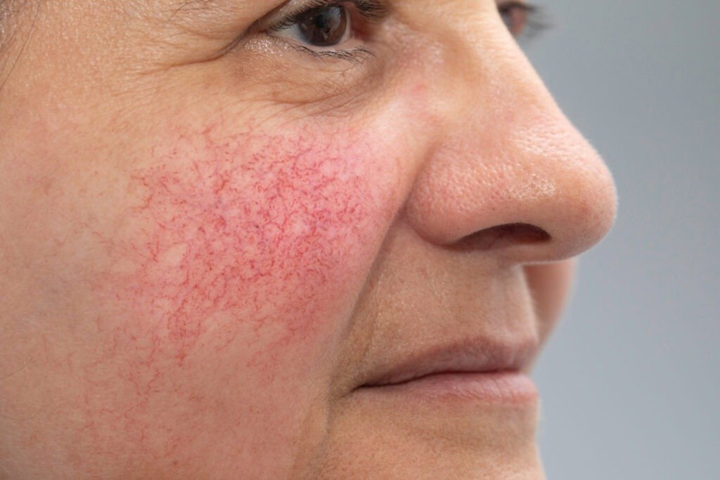 Dynamic Aesthetic Clinic Dubai