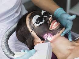 Does Laser Carbon in Dubai Peel Help with Acne and Oily Skin