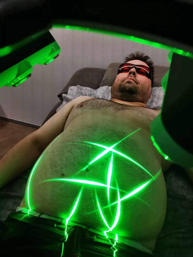 Embraces Laser Technology for Fat Reduction
