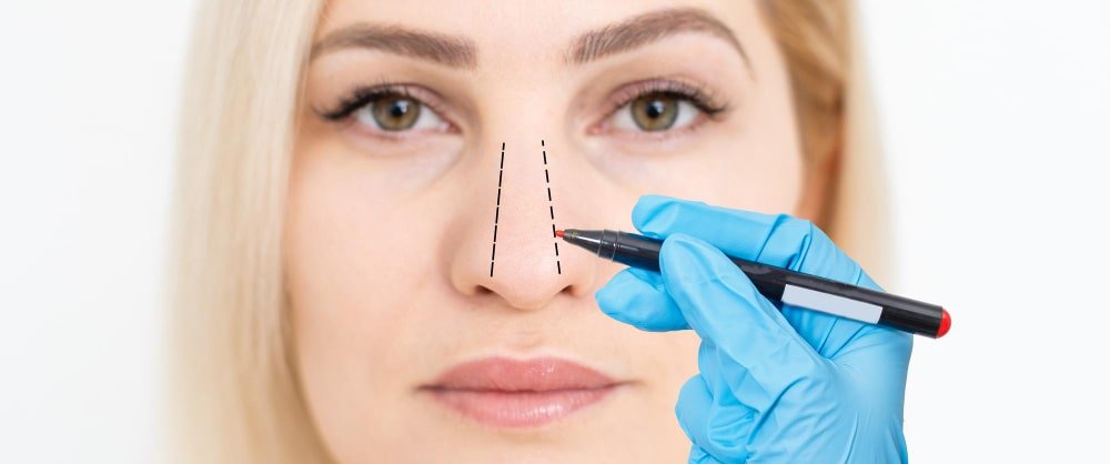 Get the Nose You Want with the Best Rhinoplasty Surgeon
