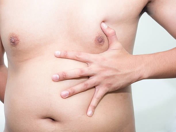 Gynecomastia in Riyadh